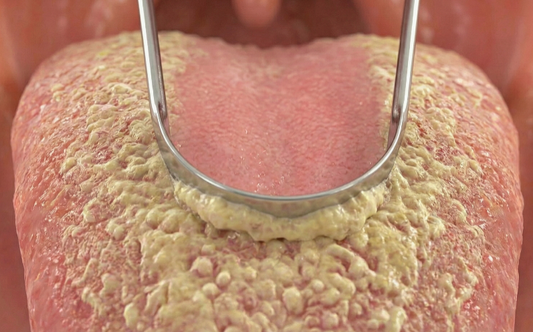 The Shocking Truth About Your Tongue (And Why a Tongue Scraper Might Be Your New Best Friend)