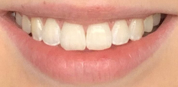 Before